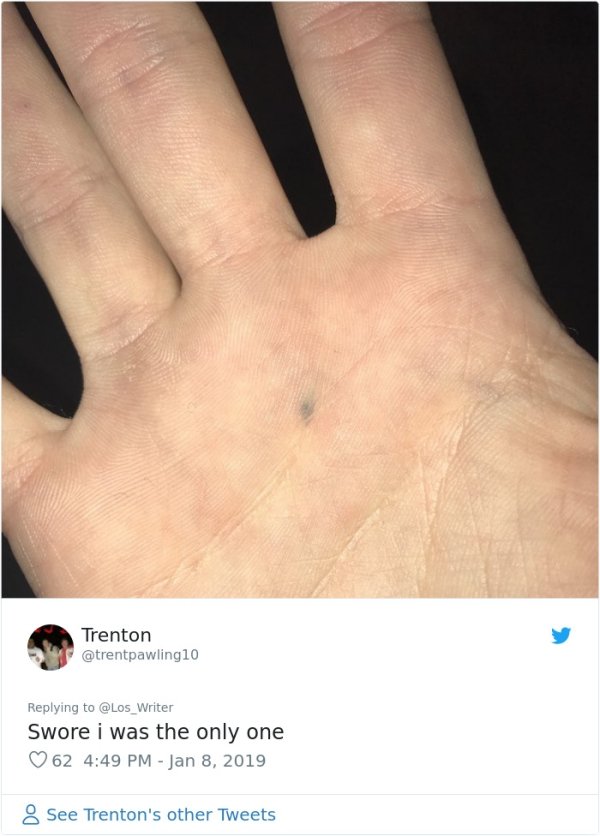 Guys Starts Community Of People With Pencil Scars