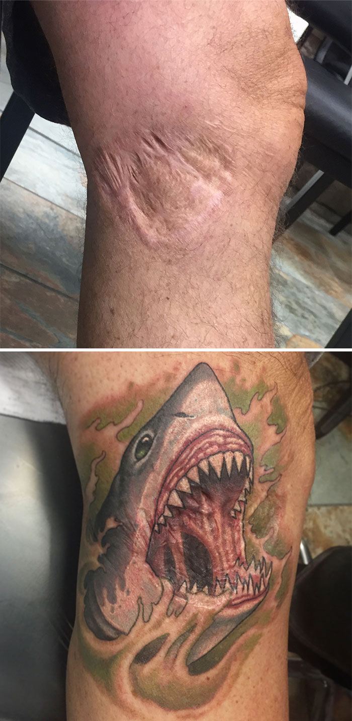 40 Amazing Tattoos People Got To Cover Their Insecurites