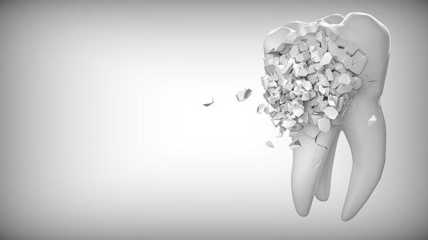 If a tooth is removed or falls out with the root intact, you can put it back in place and it will heal itself.