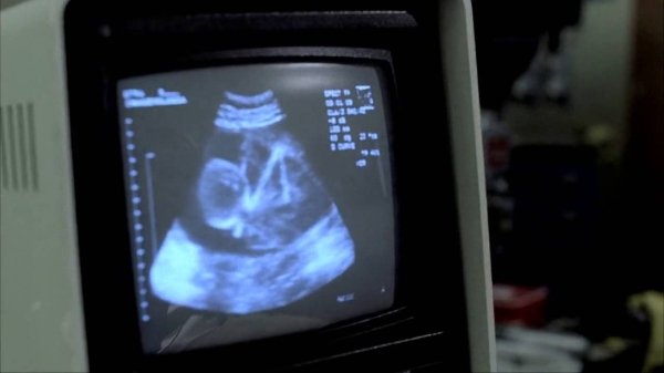 The Butterfly Effect: Evan strangling himself in the womb.
At the end of the movie, Evan originally travels back in time and strangles himself while his mother is pregnant to avoid everything that happens. The unsettling scene didn’t go well with test audiences, so the film ended differently.