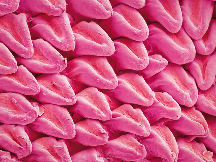 A cat’s tongue under a microscope looks like it’s made of other smaller tongues.