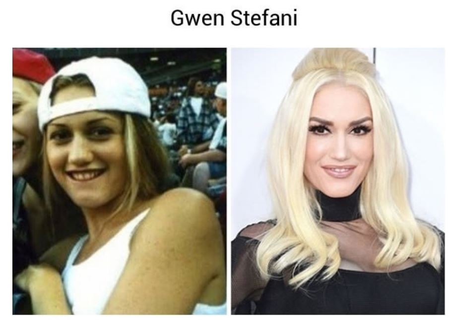 before and after famous - Gwen Stefani