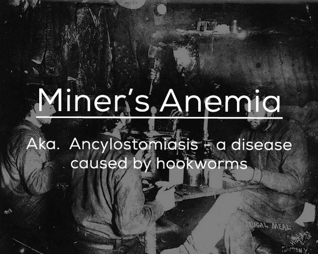 miners eating dinner - Miner's Anemia Aka. Ancylostomiasis a disease caused by hookworms Saugal Meal