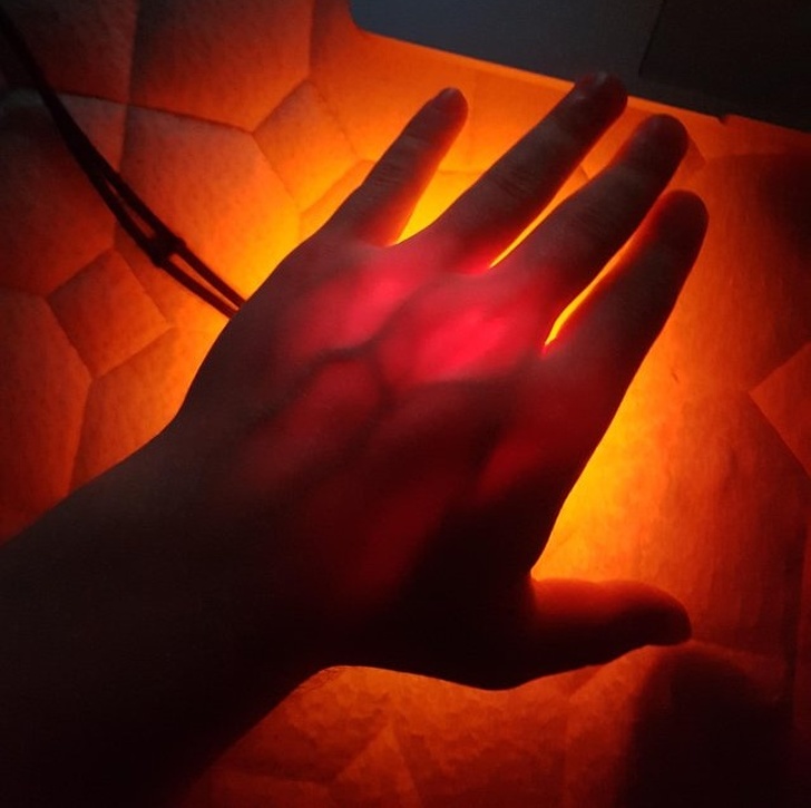 “A 4,000-lumen flashlight through my hand”