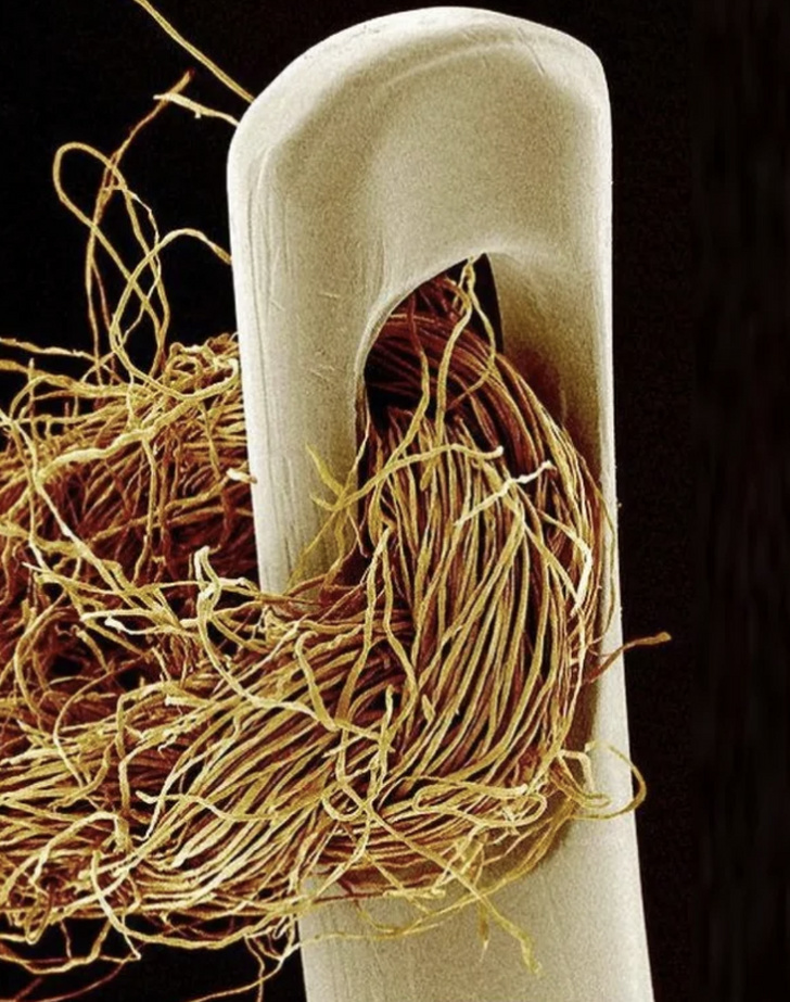 A needle and thread under an electron microscope