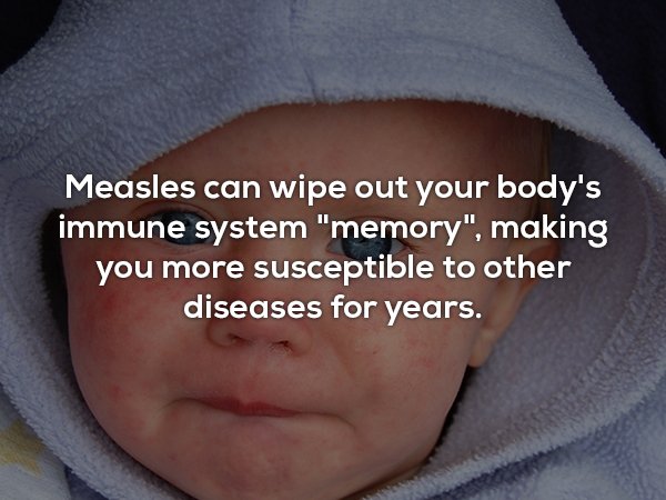 photo caption - Measles can wipe out your body's immune system "memory", making you more susceptible to other diseases for years,