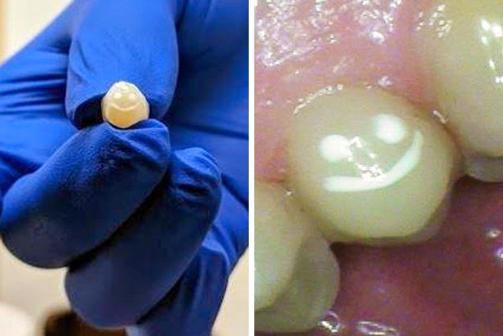 “I asked my dentist to make getting a crown less boring.”