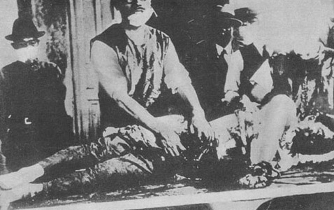 After their bomber crashed in Japan in 1945, eight American Airmen were taken to Kyushu University Medical School and dissected alive.