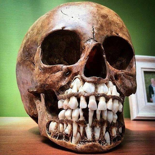 Skull of an infant. Teeth you can see in gum area are milking teeth!