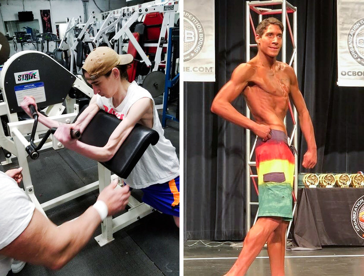 22-year-old Jared suffers from cystic fibrosis and lung cancer. He decided to get fit and achieved these incredible results in just one year.