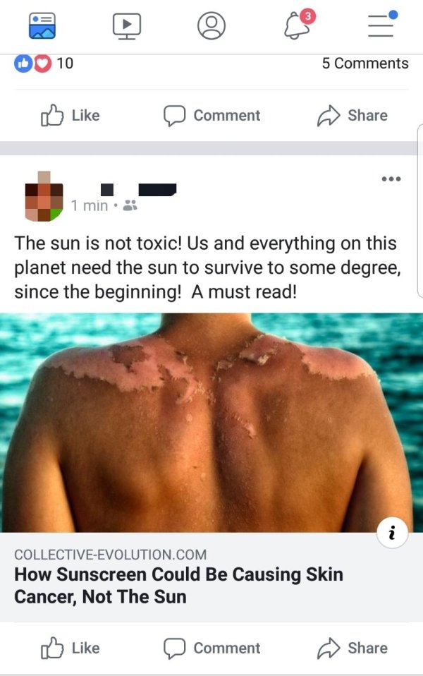 sunscreen causes cancer - Do 10 5 D Comment 1 min. The sun is not toxic! Us and everything on this planet need the sun to survive to some degree, since the beginning! A must read! CollectiveEvolution.Com How Sunscreen Could Be Causing Skin Cancer, Not The
