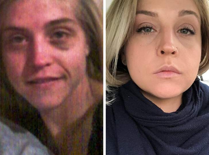 18 months of therapy and recovering from drug addiction.