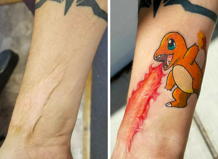 scar tattoo cover up