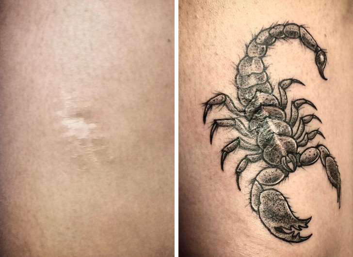 27 Skin Flaws Covered Up With Brilliant Tattoos