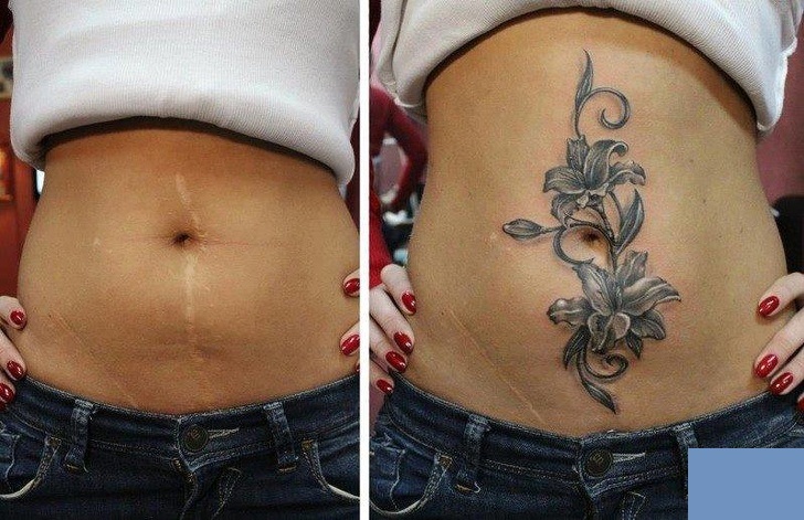stomach scar tattoo cover up