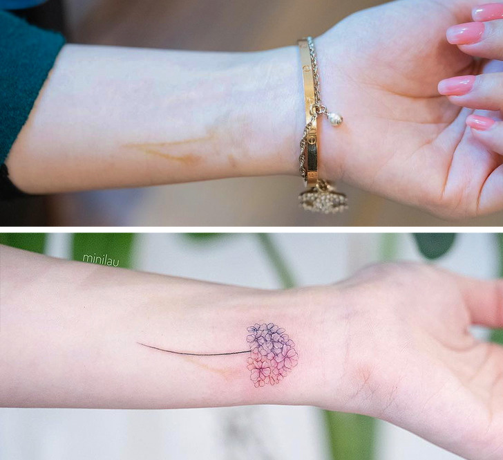 27 tattoos that turn skin flaws into masterpieces