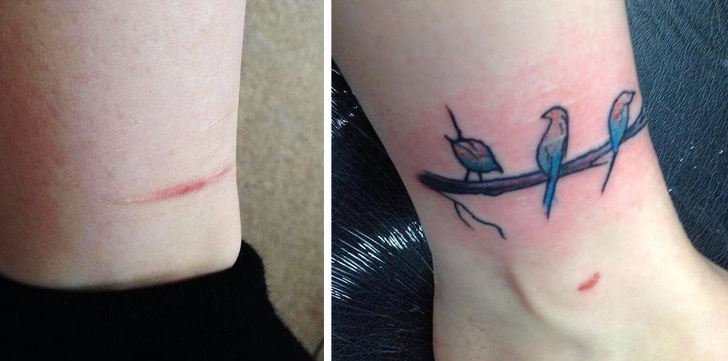 27 Skin Flaws Covered Up With Brilliant Tattoos