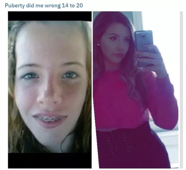 puberty made me ugly - Puberty did me wrong 14 to 20