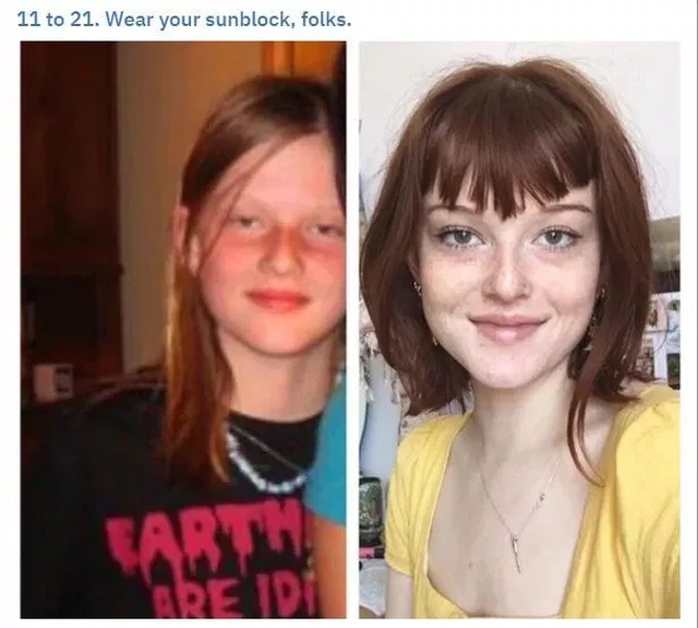 ugly duckling transformation - 11 to 21. Wear your sunblock, folks.