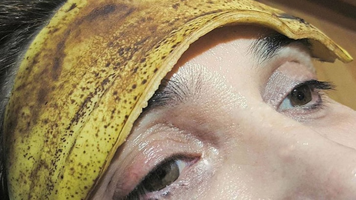 A banana peel on the head can help ease a headache.
