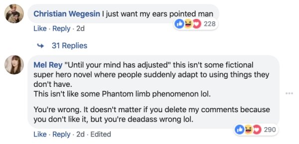 Guy Gets Roasted Online For His Ridiculous Body Modification