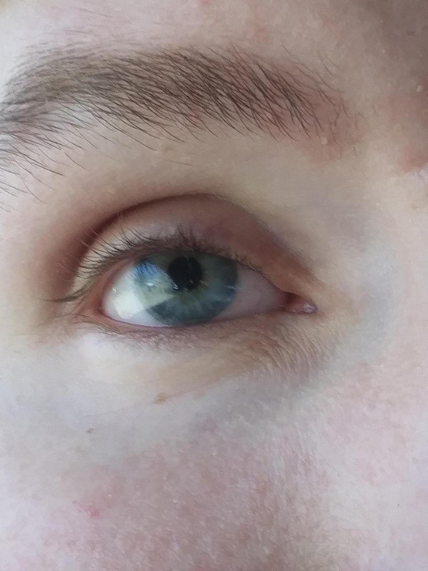 Realistic detail on a prosthetic eye.