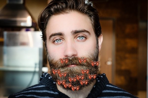 Pubic lice (crabs) are often thought of staying near your nether regions, but they can find their way to your beard, eyelashes, and even eyebrows.