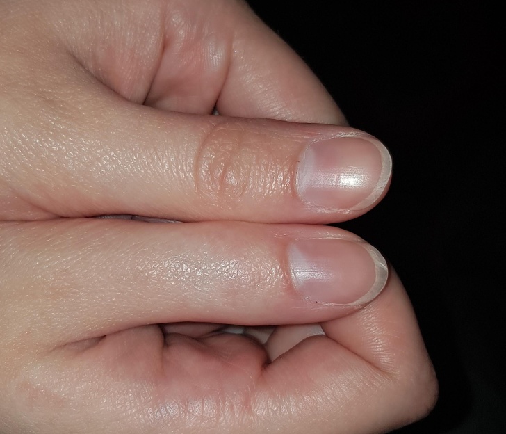 Thumb is wrinkle free.