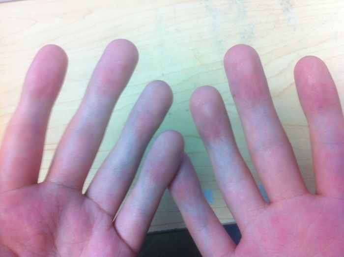a photo of a persons hands and fingers with some blue ink or chalk on them