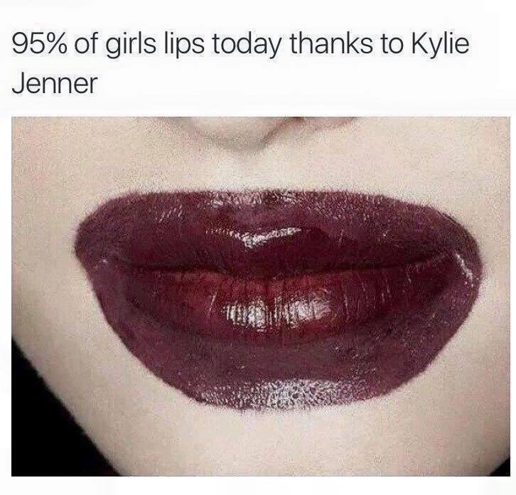bad overdrawn lips - 95% of girls lips today thanks to Kylie Jenner