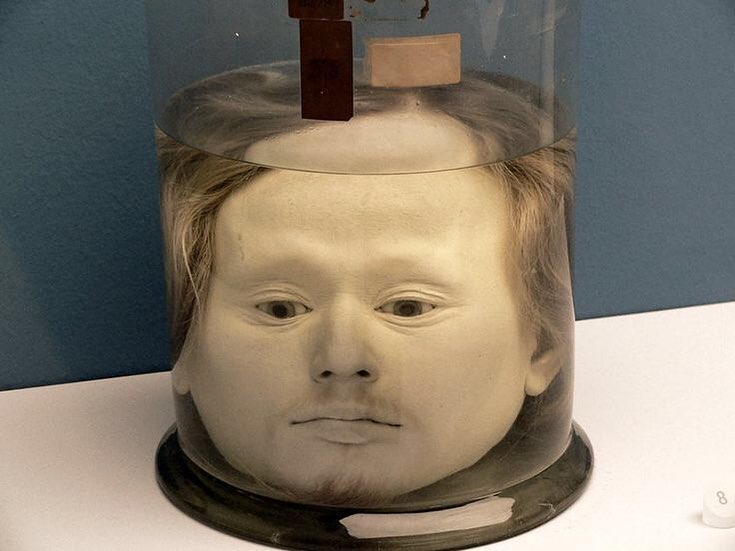 The 178 year old preserved head of Portuguese serial killer Diogo Alves.