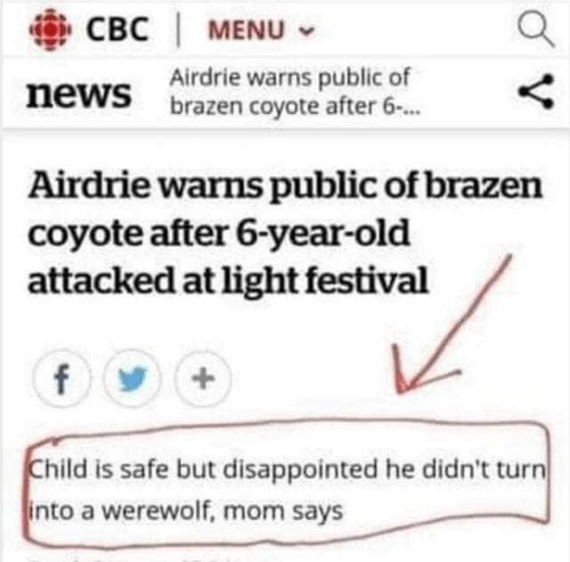 cbc news - Ocbc Menu Airdrie warns public of news brazen coyote after 6... Airdrie warns public of brazen coyote after 6yearold attacked at light festival Child is safe but disappointed he didn't turn Jinto a werewolf, mom says