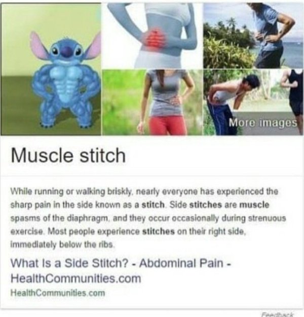 muscle stitch - More images Muscle stitch While running or walking briskly, nearly everyone has experienced the sharp pain in the side known as a stitch Side stitches are muscle spasms of the diaphragm, and they occur occasionally during strenuous exercis