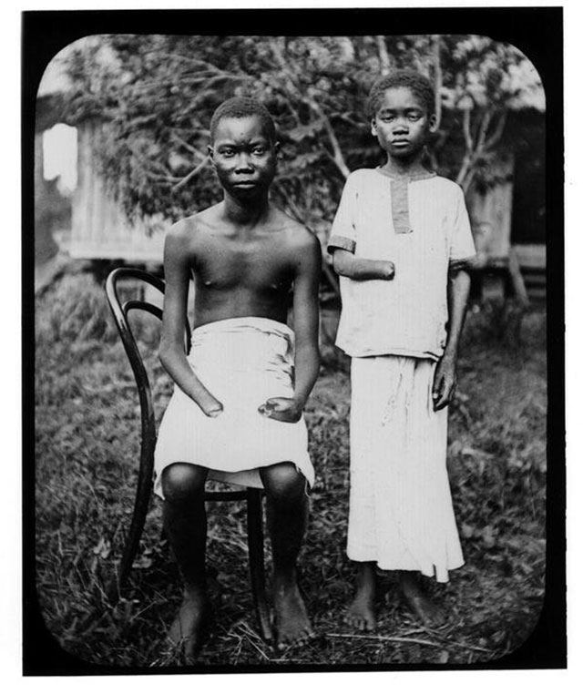 Punishment for not harvesting enough rubber, Congo, 1908.