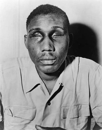 A black WW2 vet had his eyes gouged out by a local police chief. The cop was later acquitted by an all white jury.