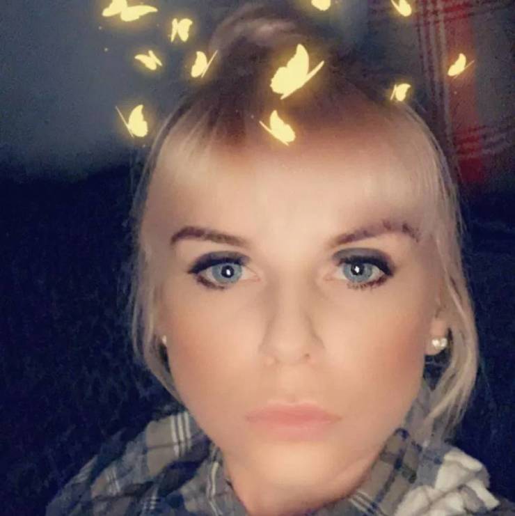 Christina Burton had to be rushed to hospital as her lips began to swell "out of control" and her throat started to close following the $100 lip filling procedure.