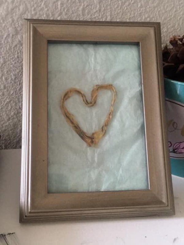 Framed umbilical cord.