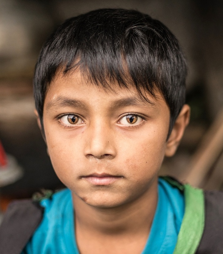 This mysterious child from Nepal has rare cat eyes.