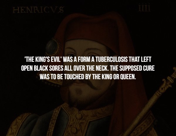 darkness - Henricvs ''The King'S Evil' Was A Form A Tuberculosis That Left Open Black Sores All Over The Neck. The Supposed Cure Was To Be Touched By The King Or Queen.