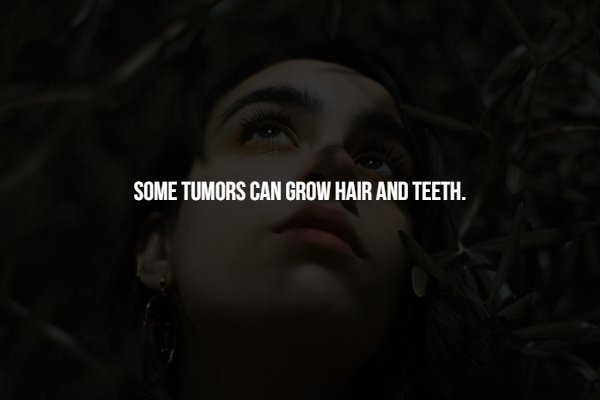 disturbing darkness - Some Tumors Can Grow Hair And Teeth.