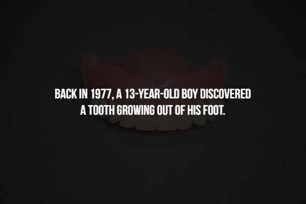 disturbing computer wallpaper - Back In 1977. A 13YearOld Boy Discovered A Tooth Growing Out Of His Foot.