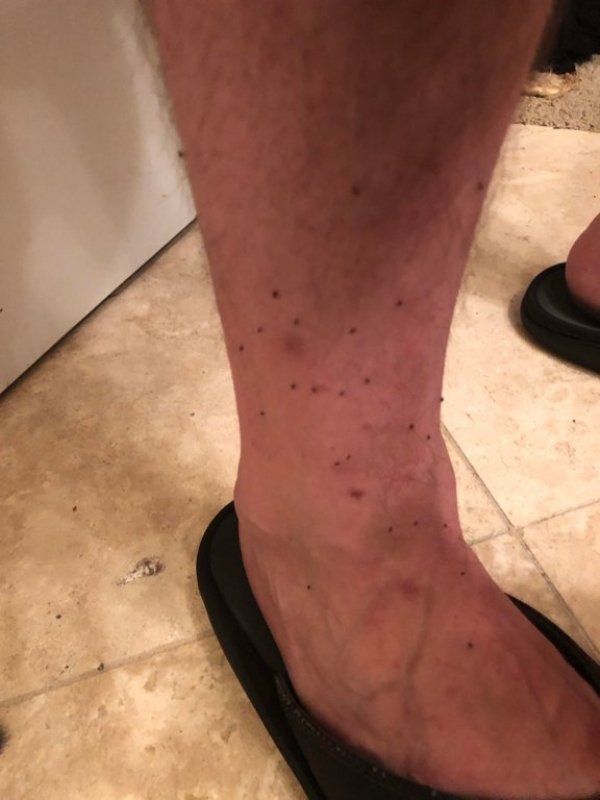 fleas on dog legs