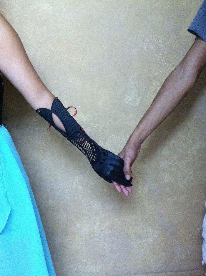 cool prosthetic arm
