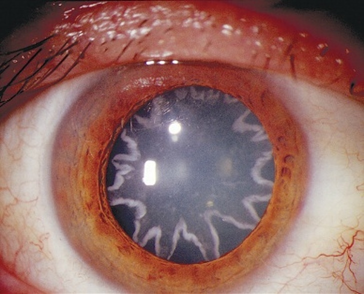 An electrician was left with stars in his eyes after experiencing a 14,000-volt shock through his body.