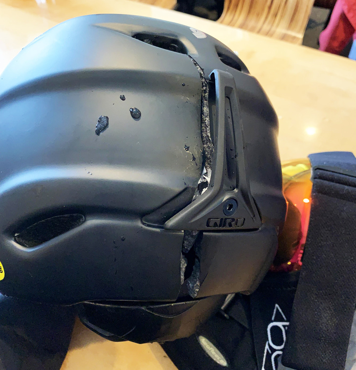 Why you need to wear your helmet.