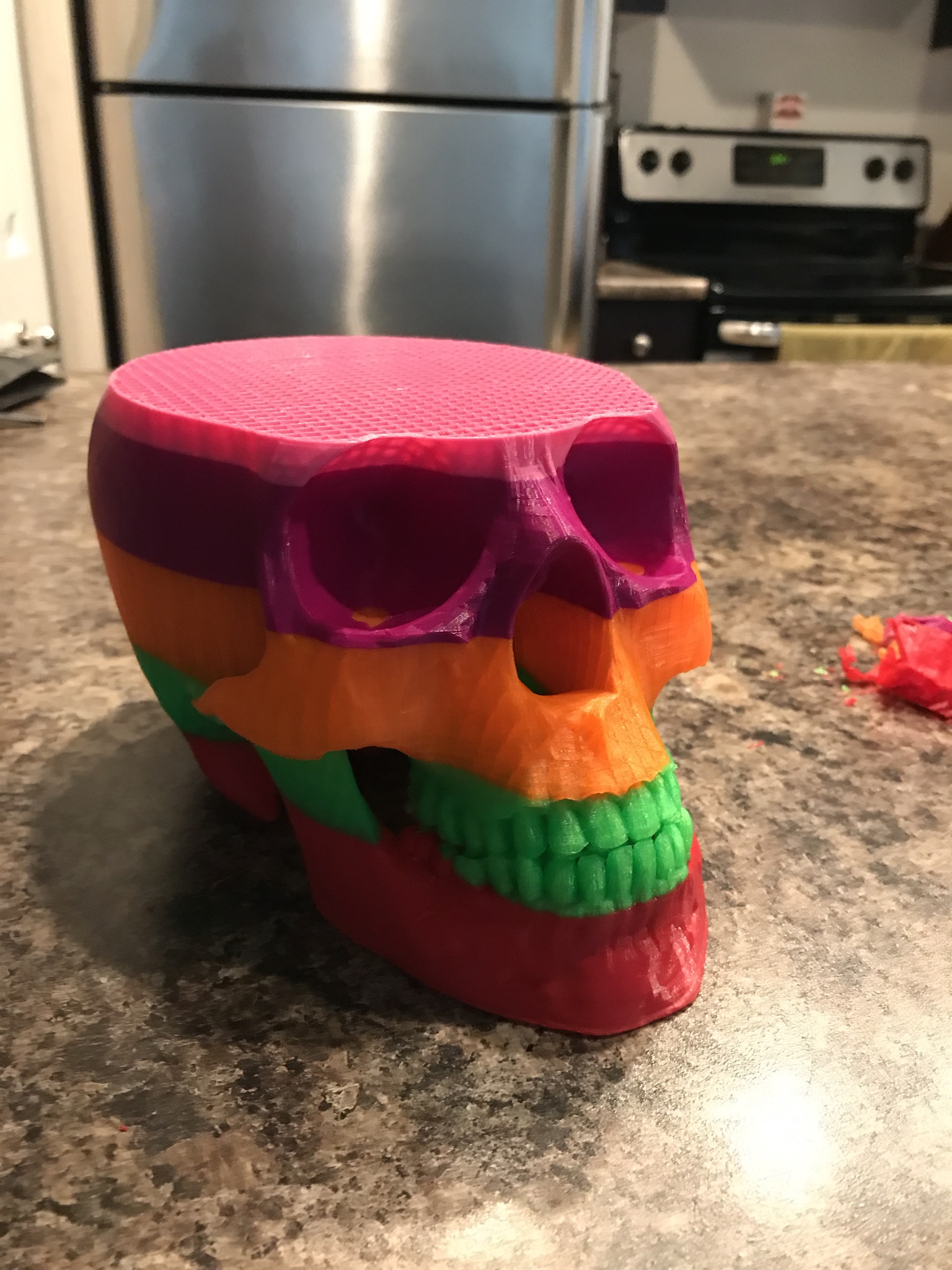 3-d printed skull