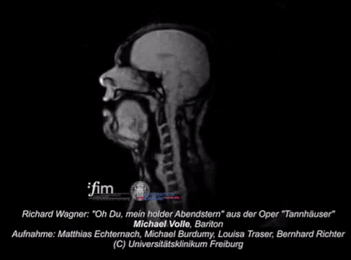 MRI of a opera singer.