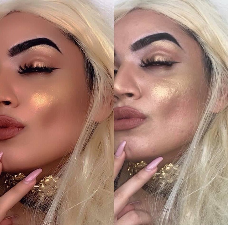 Instagram vs reality - lip injections and bad makeup