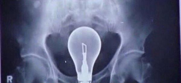 light bulb in butt x-ray