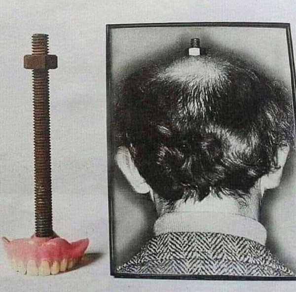 cursed images - Dentistry